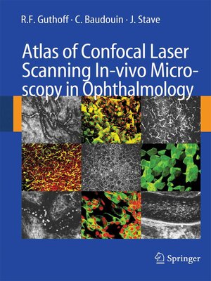 cover image of Atlas of Confocal Laser Scanning In-vivo Microscopy in Ophthalmology